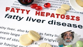 Understanding Fatty Liver Disease Hepatic Steatosis [upl. by Thisbe493]