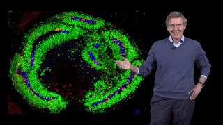 Arnold Kriegstein UCSF 2 Cerebral Organoids Models of Human Brain Disease and Evolution [upl. by Atsok]