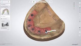 3Shape Dental System  Full Anatomy Zirconia Bridge on Implants with Gums [upl. by Arimaj]