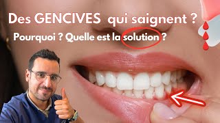 Explication GENCIVE qui SAIGNE  la solution [upl. by Tannen]