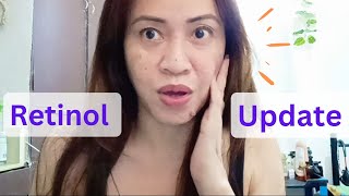 Luxe Organix Retinol Update after 6 months  Miamor delcel [upl. by Nnasus]