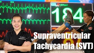 SVT Supraventricular tachycardia [upl. by Romola]