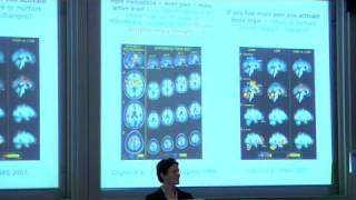 Understanding Human Pain suffering and relief through brain imaging [upl. by Abbi603]