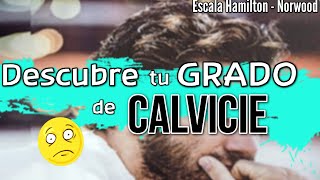 Niveles de Calvicie Masculina según Escala Norwood  ¿Cómo saber si serás Calvo [upl. by Miksen444]