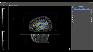 BrainMagix 20 The Brains Wiring Part 2 [upl. by Suruat164]