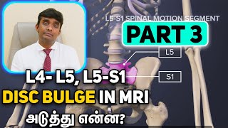 L4L5 and L5S1 Disc Bulge in MRI Whats Next Part 2 with Dr Vijayaraghavan in Tamil [upl. by Scarlet]