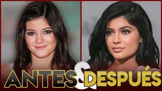 KYLIE JENNER  Transformación Antes y Después  CIRUGÍAS ESTÉTICAS [upl. by Lamont]