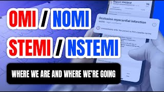 OMINOMI vs STEMINSTEMI  Where We Are and Where Were Going [upl. by Eemla]