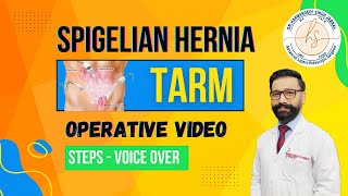 Spigelian Hernia TARM  Laparoscopic  Minimal Editing  Steps  Voice Over [upl. by Eixam]