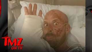 AGT Extreme Contestant Jonathan Goodwin Breaks Silence On Horrific Accident  TMZ TV [upl. by Patty184]