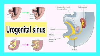 urogenital sinus [upl. by Abrams]