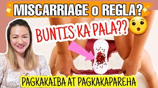 NAKUNAN NG DI NALALAMAN  MISCARRIAGE vs REGLA  Nurse Aileen [upl. by Enialb]