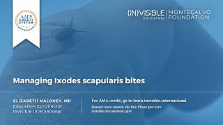 Managing Ixodes scapularis bites [upl. by Anir]