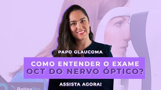 Como entender o seu exame de OCT DO NERVO Ã“PTICO [upl. by Noami]