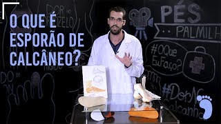 Saiba tudo sobre ESPORÃO DE CALCÂNEO [upl. by Hube]