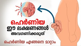 ഹെർണിയ രോഗത്തിന്റെ ഈ ലക്ഷണങ്ങൾ അവഗണിക്കരുത്  Hernia Malayalam  Hernia Symptoms [upl. by Mehsah530]