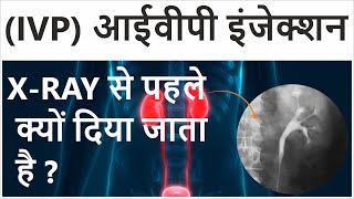 Intravenous Pyelogram in Hindi  Intravenous Pyelogram Procedure  IVP Test for Kidney [upl. by Dalohcin]