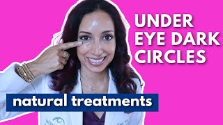 Eye Doctor Explains How To Get Rid Of Dark Under Eye Circles Naturally [upl. by Aihsenad]