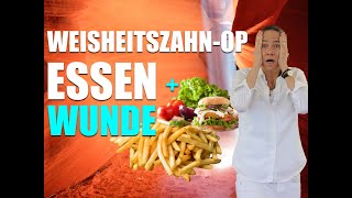 WeisheitszahnOP WUNDE kann ESSEN einwachsen [upl. by Raamal775]