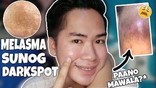 MELASMA SA MUKHA PAANO MAWALA MADALING SOLUSYON PARA SA MELASMA❤️ [upl. by Elocan]