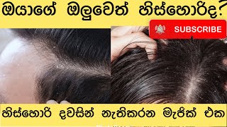 Home Made Dandruff Treatment sinhala  hishori walata behethak [upl. by Deeann930]