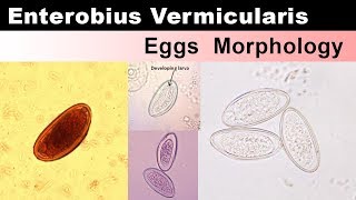 Enterobious Vermicularis Eggs Morphology [upl. by Ymot]