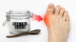 The 1 Remedy for Gout Attacks WORKS FAST  Dr Berg [upl. by Ahsiemat]