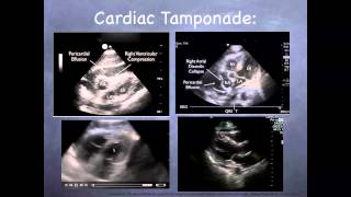 Tutorial Basic echocardiography [upl. by Grekin]