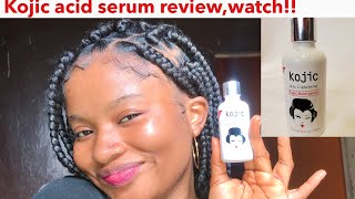 Kojic acid serum reviewkojic acid review [upl. by Heyward]