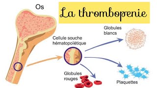 les étiologies des thrombopénies [upl. by Htiel]