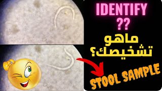 Identify series 2سلسلة ماهو التشخيص 2 [upl. by Salvay]