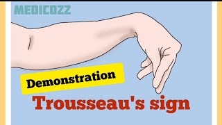 Trousseaus sign in Hypocalcemia  Patient video  causes treatment prevention [upl. by Ridan]