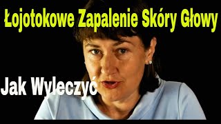 Łojotokowe zapalenie skóry głowy Jak wyleczyć [upl. by Galanti]