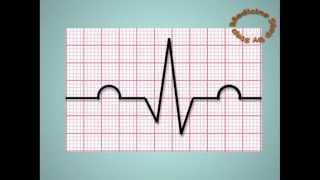 Understanding ECGs  EKG [upl. by Engvall]