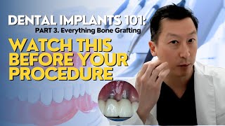 Find out how dental implants work [upl. by Harsho]