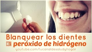 Cómo blanquear dientes con peróxido de hidrógeno [upl. by Erdnassac]