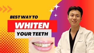 Best Teeth Whitening Method  DENTIST ANSWERS [upl. by Patman]