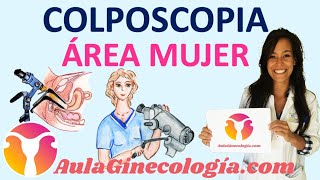 COLPOSCOPIA QUÉ ES CÓMO se realiza COMPLICACIONES y CUIDADOS  Ginecología y Obstetricia [upl. by Atinomar]