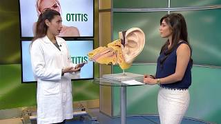 Causas y síntomas de la otitis HOY EN SALUD [upl. by Daveta]