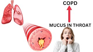 The 4 Causes Of Constant Mucus In Your Throat  Inspired By Dr Eric Berg DC [upl. by Spalla185]