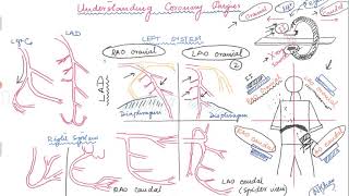 Basics of angiographic views during left heart catheterization [upl. by Erdnaed]