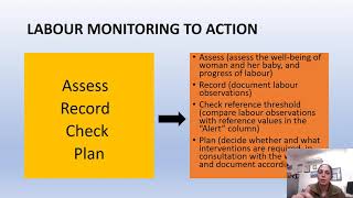 labor care guide time to change from Partogram to Labor care guide by WHO Dr Prof ArunaNigam [upl. by Yelroc]