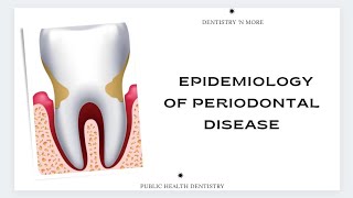 EPIDEMIOLOGY OF PERIODONTAL DISEASE [upl. by Julia]