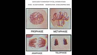 QUICK GUIDE TO ONION ROOT TIP CELL DIVISION STAGES PROPHASE METAPHASE ANAPHASE amp TELOPHASE [upl. by Aihsakal596]