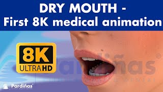 DRY MOUTH  Causes and remedies of xerostomia  WORLDS FIRST MEDICAL ANIMATION IN 8K © [upl. by Hurlbut]