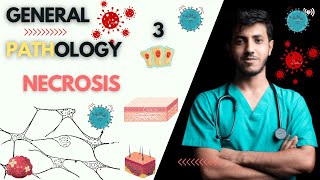 General Pathology Course  lecture 1  part 3  Necrosis  كورس علم الأمراض [upl. by Ellitnahc]