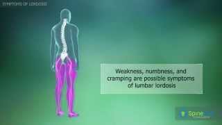 Lordosis Symptoms [upl. by Frech]