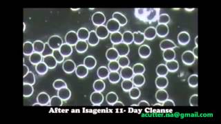 Isagenix blood cells before and after cleanse video Live blood analysis [upl. by Ragse]