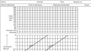 How to plot partograph  obs amp gynae  Labor [upl. by Snyder708]