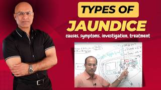 Types Of Jaundice  Causes Symptoms amp Treatment  Dr Najeeb [upl. by Whorton]